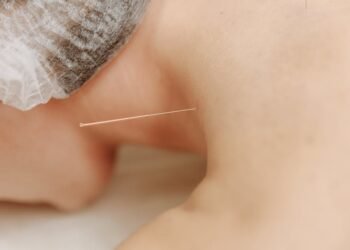 Need To Know What Acupuncture Is All About?