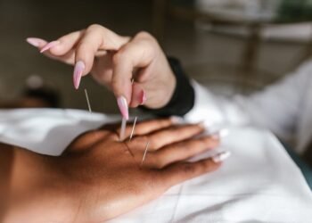 Reap The Benefits Of Acupuncture With These Tips